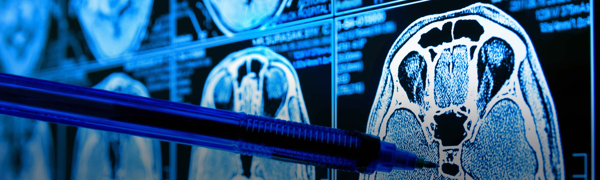 Medical Imaging Mobile Xray Neousys Technology